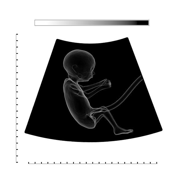 Jak se připravit na ultrazvuk plodu a⁢ co ⁤můžete ⁢očekávat během procedury?